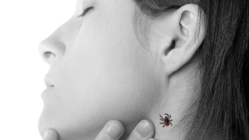 Kleszcz w skóze człowieka